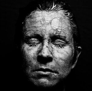 ノネナールと皮膚の常在菌のバランスを保つ方法は？